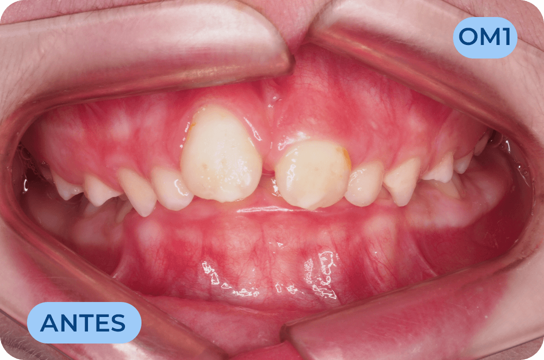 Odontologia Miofuncional